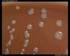 Haemophilus influenzae